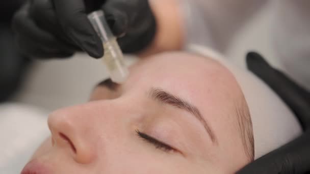 Procedimiento Microneedle Procedimiento Rejuvenecimiento Facial Para Una Mujer Imágenes Alta — Vídeos de Stock