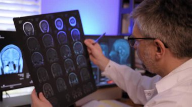 Doktorlar bir tıp hastanesinde hastanın MRI taramasını inceleyip beyin hastalıklarını teşhis eder ve tedavi planlar. Yüksek kalite 4k görüntü