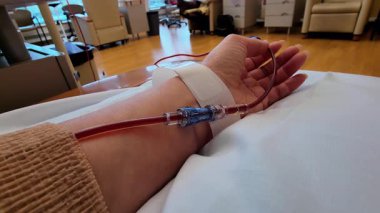 Tıbbi tedavi devam ediyor. Kadın hasta, bir sağlık merkezinde yatıyor. Yüksek kalite 4k görüntü