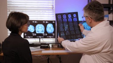 Nörologlar ve hasta beyin durumlarını değerlendirmek ve tedavi seçeneklerine karar vermek için MRI taramalarını inceliyor. Yüksek kalite 4k görüntü