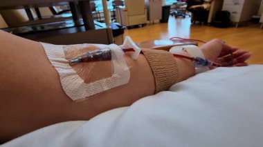 Tıbbi tedavi devam ediyor. Kadın hasta, bir sağlık merkezinde yatıyor. Sıvılar, ilaçlar ve besinler için serum. Yüksek kalite 4k görüntü