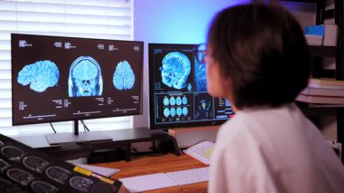 Bir hastanın MRI taramasını inceleyen doktor beyin durumlarını ve tedaviyi ve tedaviyi planlamak için. Yüksek kalite 4k görüntü