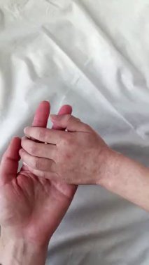Doktor çocuğun elini muayene eder. Ellerinde kızarıklık ya da kırmızı lekeler var. Çocukluk viral hastalıklarını kavra. Dikey video.
