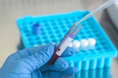 Bir laboratuvar teknisyeninin ellerinde bir tüp kan örneği ve diğer numunelerle dolu bir raf var. Üzerinde çalışmak için kan tüpü örneği tutan laboratuvar teknisyeni. Corona virüsü salgını konsepti. Coronavirus aşısı gelişimi.