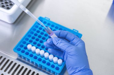 Bir laboratuvar teknisyeninin ellerinde bir tüp kan örneği ve diğer numunelerle dolu bir raf var. Üzerinde çalışmak için kan tüpü örneği tutan laboratuvar teknisyeni. Corona virüsü salgını konsepti. Coronavirus aşısı gelişimi.