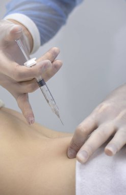 Fizyoterapist bir hastanın sırtına iğne yapıyor.