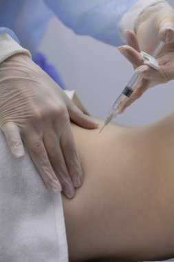 Fizyoterapist bir hastanın sırtına iğne yapıyor.