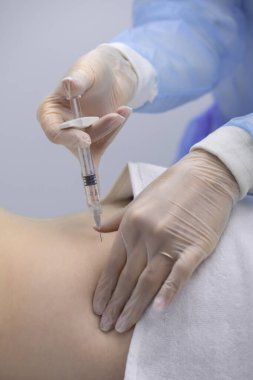 Fizyoterapist bir hastanın sırtına iğne yapıyor.