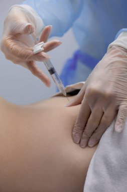 Fizyoterapist bir hastanın sırtına iğne yapıyor.