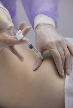 Fizyoterapist bir hastanın sırtına iğne yapıyor.