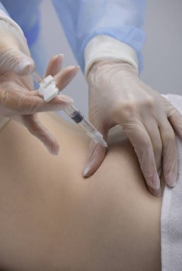 Fizyoterapist bir hastanın sırtına iğne yapıyor.