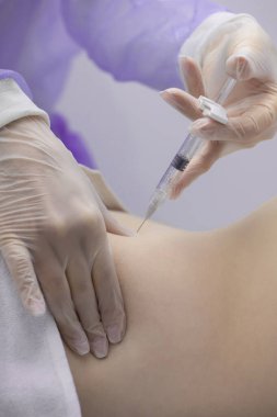 Fizyoterapist bir hastanın sırtına iğne yapıyor.