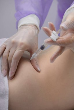 Fizyoterapist bir hastanın sırtına iğne yapıyor.