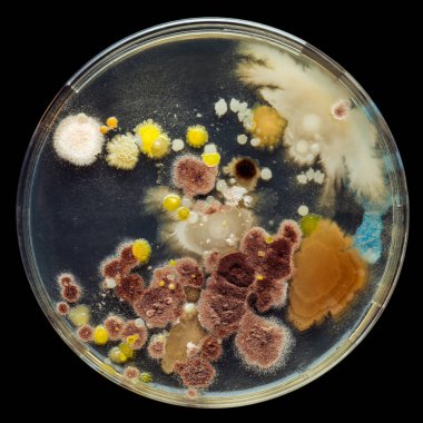 Birkaç bakteri kültürüyle dolu bir petri kabı. Mikropların, bakteriyel enfeksiyonların ve ölümcül hastalıkların tehlikeleri üzerine bilimsel araştırmalar.