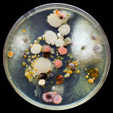 Birkaç bakteri kültürüyle dolu bir petri kabı. Mikropların, bakteriyel enfeksiyonların ve ölümcül hastalıkların tehlikeleri üzerine bilimsel araştırmalar.