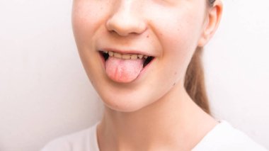 Yüzeyde doğum izleri var. Genç kız beyaz duvar dokusunda dilini gösteriyor.