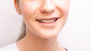 Genç kız yüzünün alt kısmını kapat, beyaz arka planda parantezlerle gülümse.