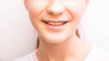 Genç kız yüzünün alt kısmını kapat, beyaz arka planda parantezlerle gülümse.