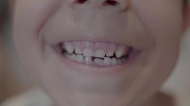 Kayıp diş. Süt dişi kaybolan ve kalıcı olarak büyüyen gülümseyen bir çocuğa yaklaş. Yüksek kalite 4k görüntü