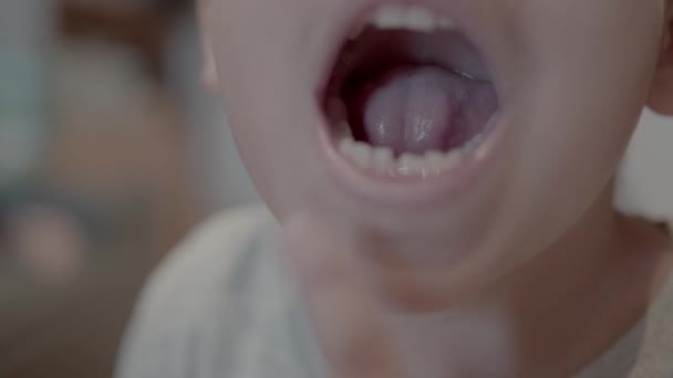 足りない歯 ミルクの歯が欠けていて成長している笑顔の子供に近づいてください 高品質の4K映像 — ストック動画