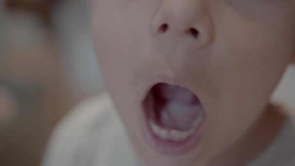 Dente Mancante Vicino Bambino Sorridente Che Mostra Denti Latte Mancanti — Video Stock