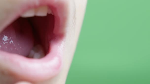 Avvicinati Denti Latte Dei Bambini Ragazzo Che Muove Dente Filmati — Video Stock