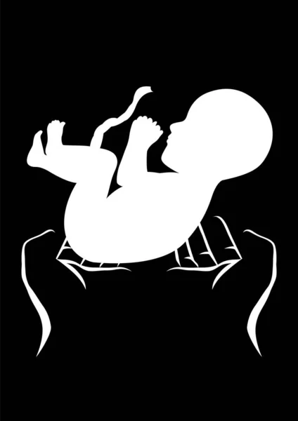 Fetüsü Doğumu Doğum Uzmanını Kürtaj Konseptini Elinde Tutan Siyah Beyaz — Stok Vektör