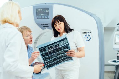 Bir kadın, bir kadının kafasının tıbbi görüntüsüne bakıyor. Beyaz laboratuvar önlüğü giyen iki kadın doktor ve mavi gömlekli bir kadının yanında duruyor.
