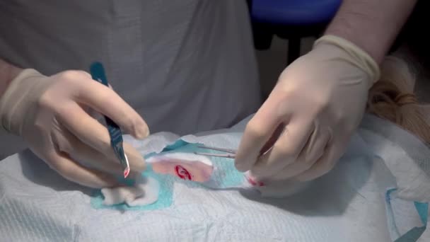 Médecin Utilisant Scalpel Pendant Une Opération — Video