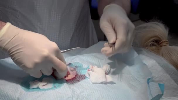 Médico Usando Tijeras Una Pinza Durante Una Cirugía — Vídeos de Stock