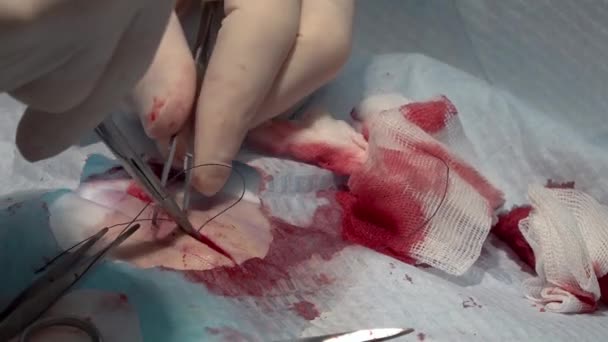 Lekarz Zszywający Ranę Igłą Samodzielnie Rozpuszczającą Się Nitką Podczas Operacji — Wideo stockowe