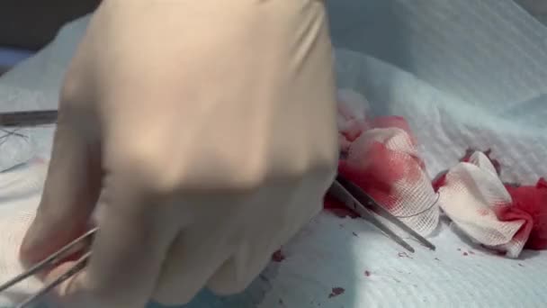 手術中に針と自己溶解糸で傷を縫う医師 — ストック動画