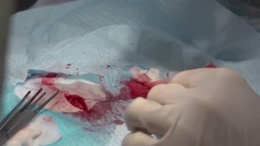 Doktor iğne yarasıyla dikiş atıyor ve ameliyat sırasında ipliği eritiyor.