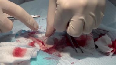 Doktor iğne yarasıyla dikiş atıyor ve ameliyat sırasında ipliği eritiyor.