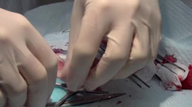 Doktor iğne yarasıyla dikiş atıyor ve ameliyat sırasında ipliği eritiyor.