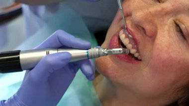 Kendini işine adamış bir kadın dişçi, üst beyaz bir kadının ön dişleri boyunca bir kupa kupayı ustalıkla manevra ettiriyor ve eksiksiz bir cilalama sağlıyor. Diş hijyenisti müşterileri nazikçe üst dudağında tutar ve sakin bir ayna oluşturur.