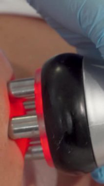 Olgun bir kadının, canlandırıcı bir yüz kaldırma prosedürü deneyimlediği, ışıl ışıl radyofrekans cihazını iş başında gösteren yakın plan bir fotoğrafı. Yetenekli kozmetikçi aleti nazikçe derisinin üzerine süzüp sıkılaştırma ve gençleştirmeyi teşvik ediyor.