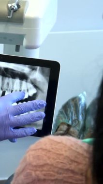 Canlı yeşil bir tıbbi elbise giyen merhametli bir beyaz diş hekimi, hasta merkezli tedaviye olan bağlılığını göstermek için şık bir tablette gösterilen röntgen görüntüsünü dikkatle analiz ediyor. Modern diş kliniği ayarları ışıldayan dişlerle vurgulanır