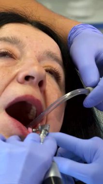 Mavi eldiven giyen kendini işine adamış bir dişçi yetişkin hastasının alt dişlerini ustalıkla cilalıyor ve olağanüstü diş bakımına olan bağlılığını vurguluyor. Olay yeri, karmaşık diş prosedürünü net bir şekilde yakalıyor, hijyenistin kullandığı...