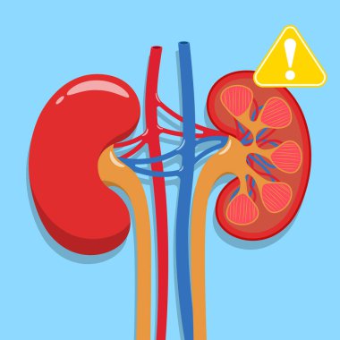 Böbrek sağlığı vektör konsepti. Doktorlar idrar yolu hastalığını teşhis etmek için bilgi arıyorlar. Böbrek yetmezliği, böbrek taşı, kalp krizi tedavisi, tıbbi konsept.