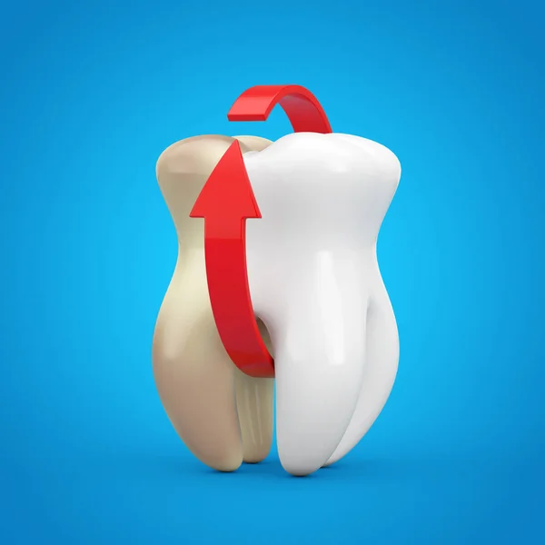 Зуби Пробуджують Концепцію Білий Зуб Червоною Стрілою Синьому Фоні Рендеринг — стокове фото