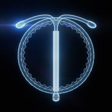 Doğum Kontrol Konsepti. X-Ray T-Shape IUD Bakır Rahim İçi Cihazı siyah zemin üzerinde. 3d Hazırlama