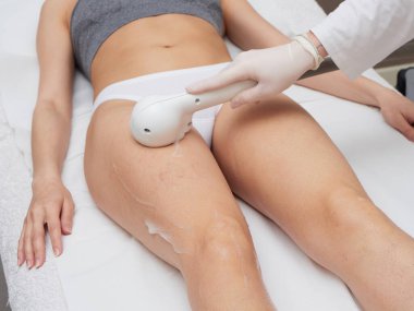 Güzellik uzmanı lazer tedavisiyle genç kadınların saçlarını alıyor.