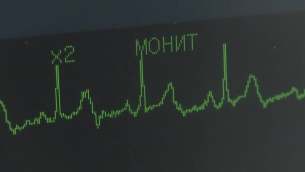 Sali Operacyjnej Akcja Mężczyzna Leżący Szpitalu Który Patrzy Prześwietlenie Serca — Wideo stockowe