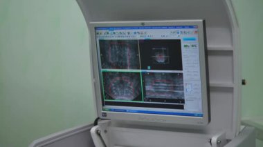 Almanya - Berlin, 5 Mart 2023: Ultrason makinesi ekranı. Yaratıcı. Tıp ve tıbbi ekipman kavramı