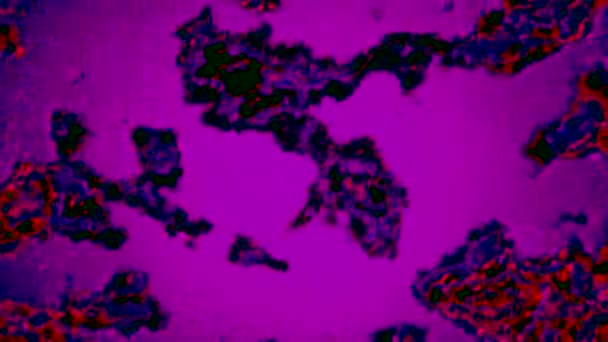 Obrazovce Pohybuje Virus Lidského Imunitního Systému Pohyb Bakteriální Virus Nebo — Stock video