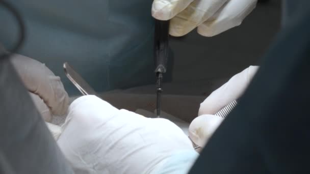 Operatie Van Dichtbij Actie Chirurgische Handen Uitvoeren Van Operatie Met — Stockvideo