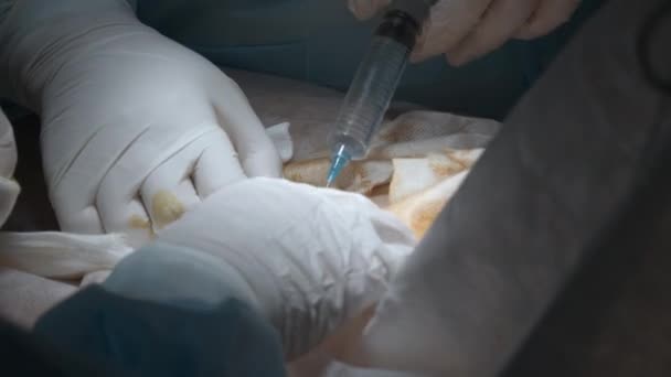 手術が終わりました アクション 手術中に注射をする医師の手 — ストック動画