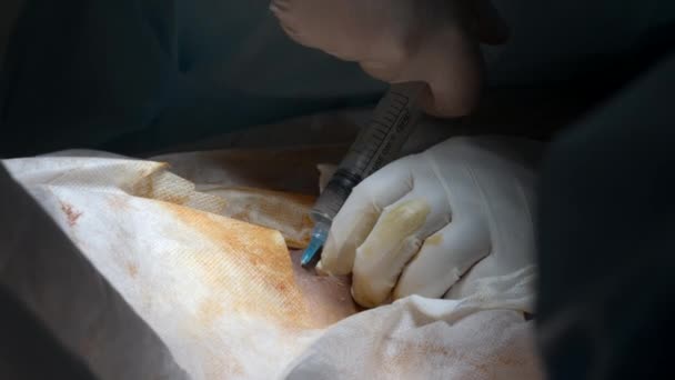 患者の体の皮膚の下に針を挿入する アクション 注射をする手袋の外科医のクローズアップ — ストック動画