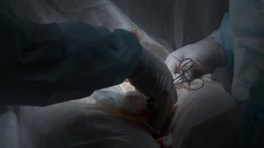 Tıbbi prosedür sırasında açık bir yarayı dağlayan profesyonel cerrahlara yakın durun. Başla. Profesyonel ekipman kullanan temiz üniformalı doktorlar.